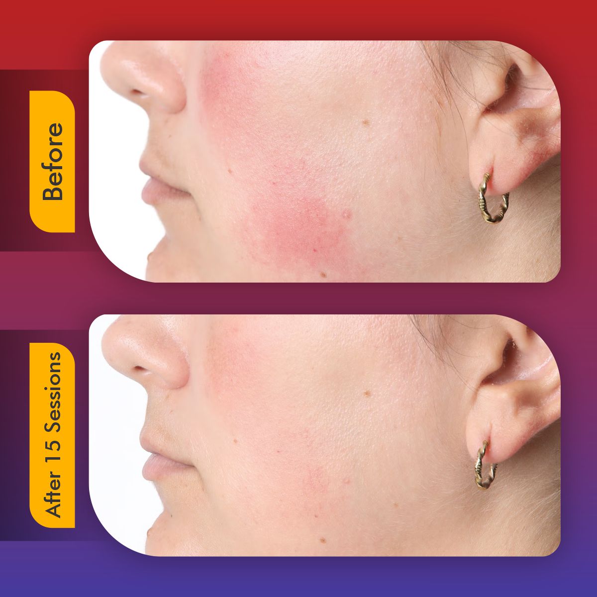 Ergonomist ® LED Face Mask