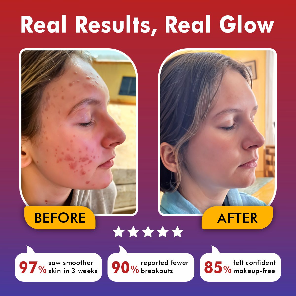 Ergonomist ® LED Face Mask